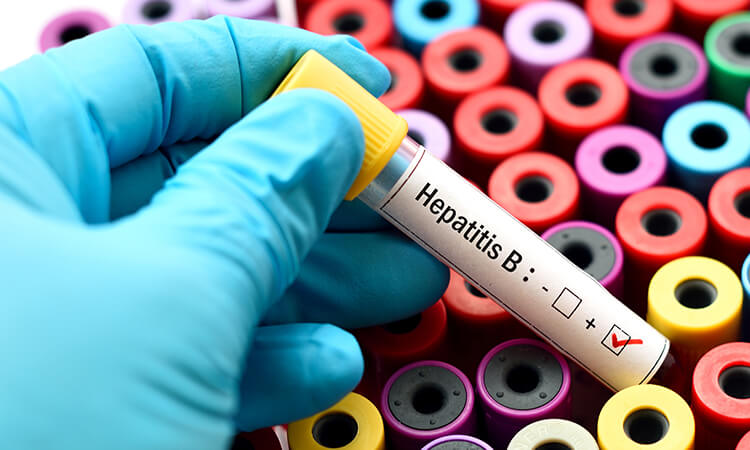 Everything you should know about Hepatitis B on this World Hepatitis Day